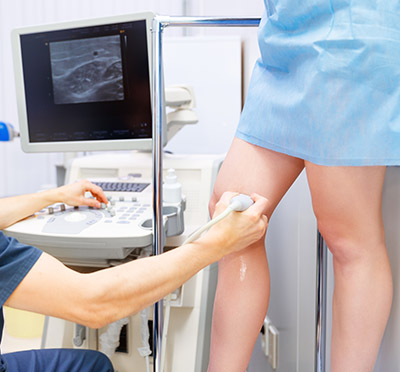 Varicose Veins Ultrasound Cobertura De Seguro Para Venas Varicosas: ¿Lo Cubre Tu Seguro?