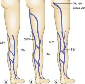 Great Saphenous vein and short saphenous vein