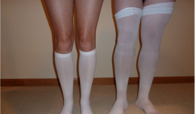 Cant keep your stockings up