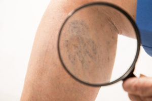 svmagnifying-glass-1030x687