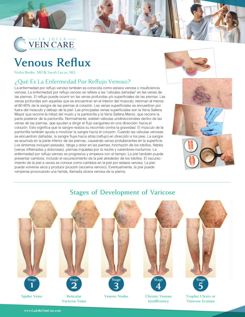 Enfermedades de las Venas Espanol 1