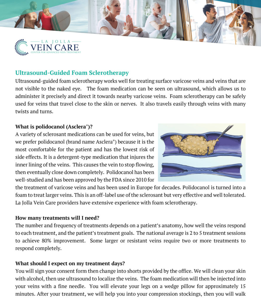 Foam Sclerotherapy 1