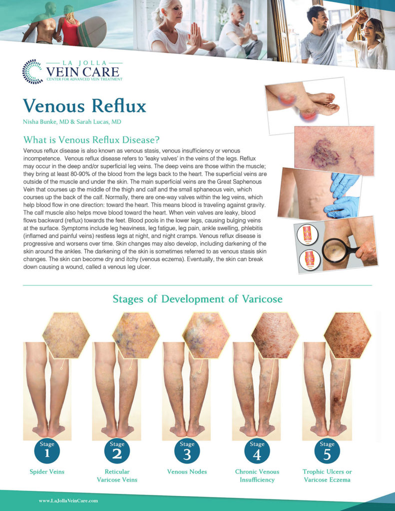 Venous Reflux Disease 1