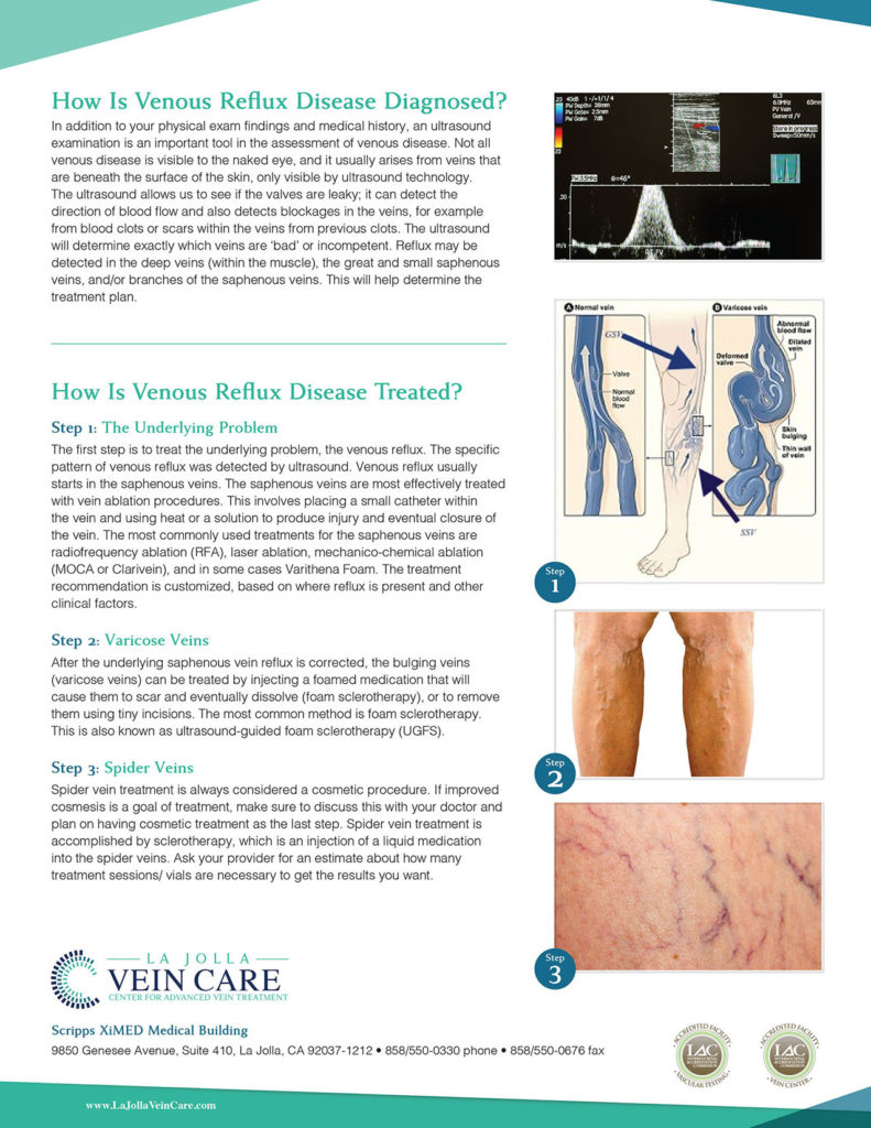 Venous Reflux Disease 2