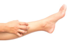 itchy legs