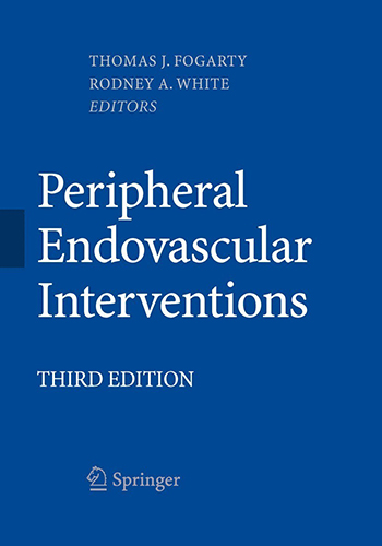 peripheral endovascular interventions