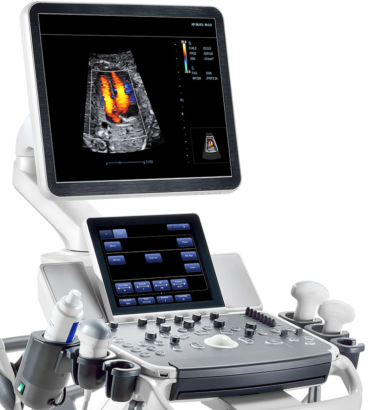 How Ultrasound Can Detect Hidden Dangers in Leg Veins Not Visible to the Naked Eye