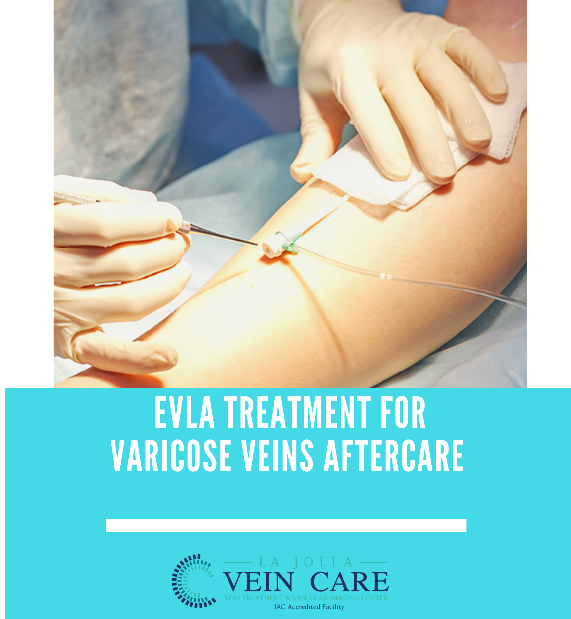 evla recovery