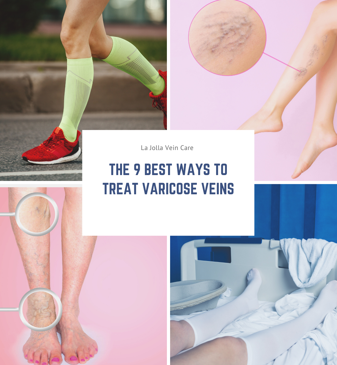 varicoseveinmanagement the 9 best ways to treat varicose veins
