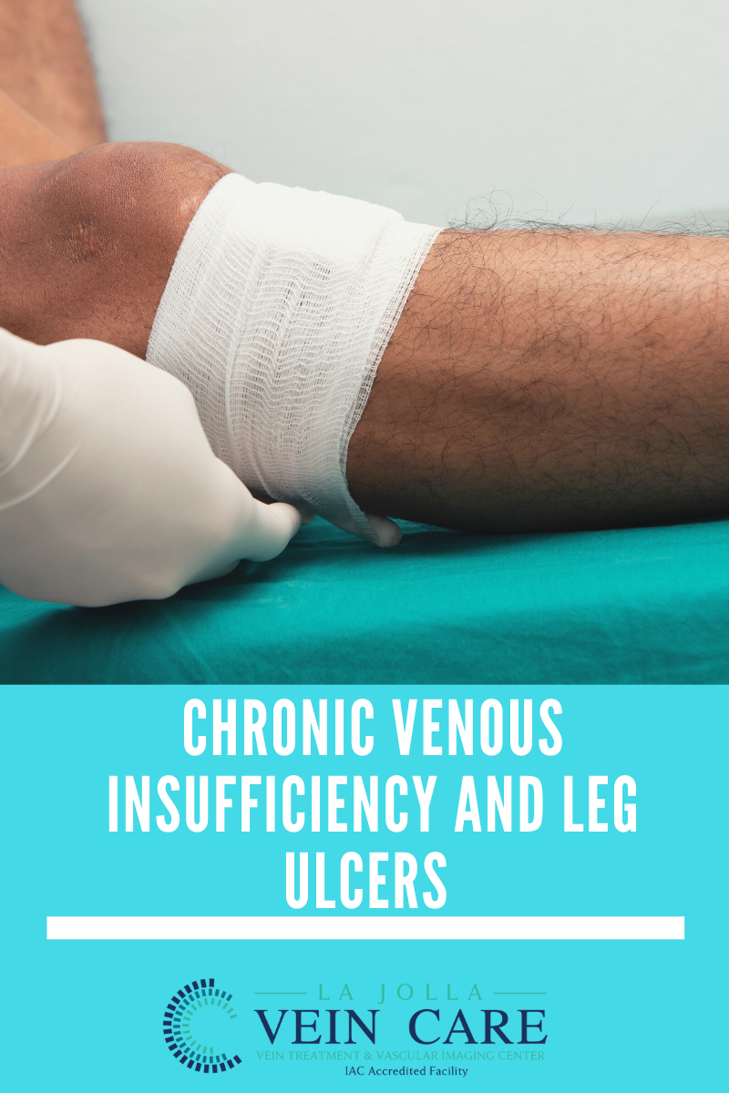 Bunke Blog Graphics5-7 leg ulcer