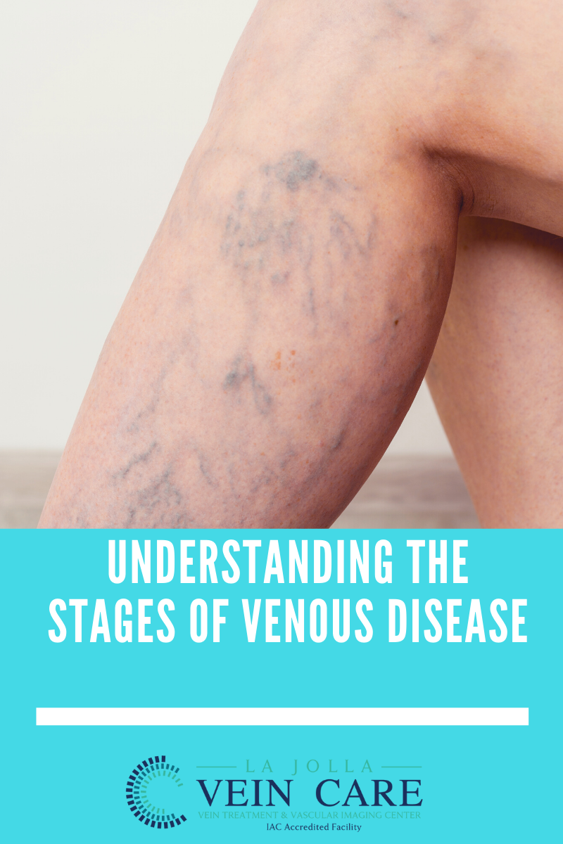 venous stages