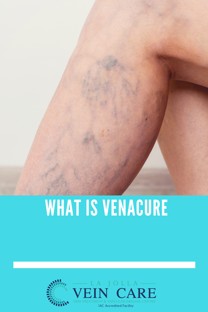 venacure venacure