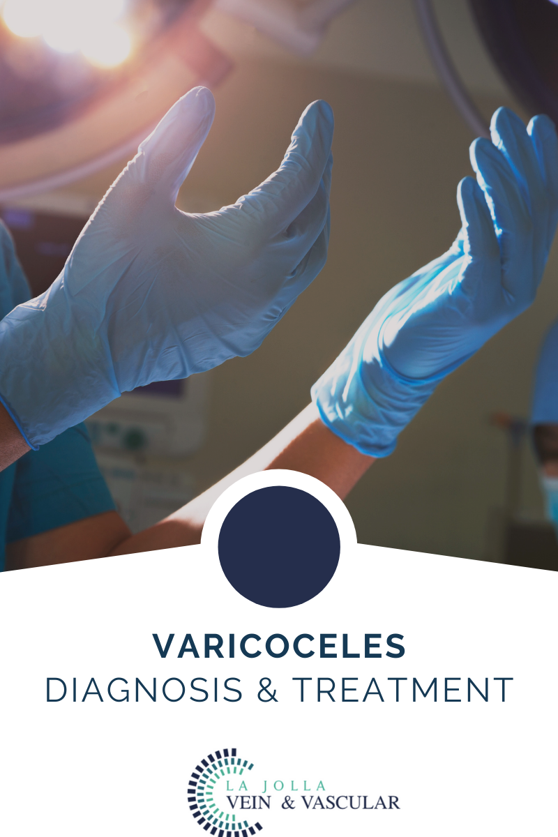 3 varicoceles