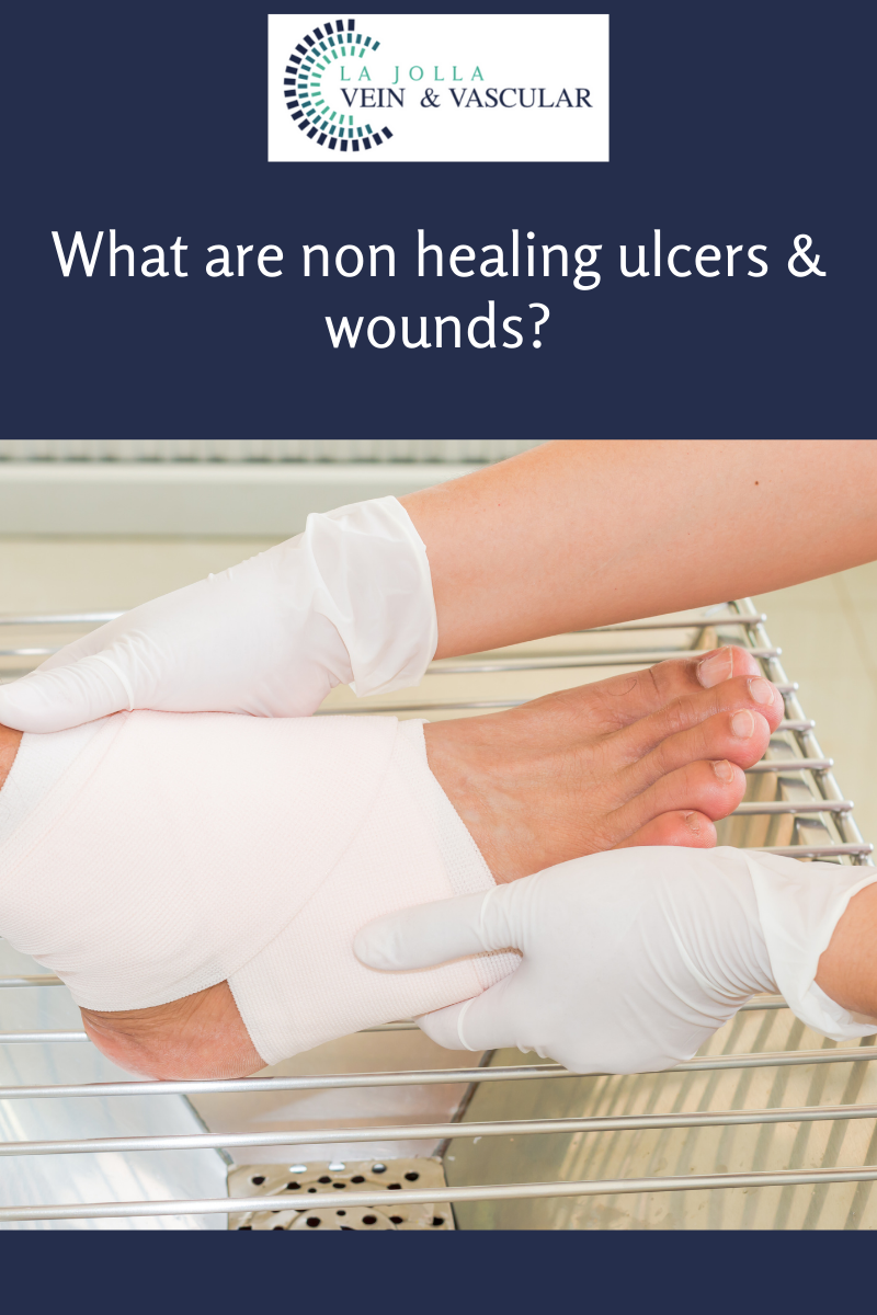 5 whatarenonhealingulcers