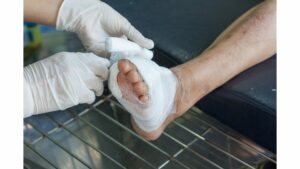 diabetes foot