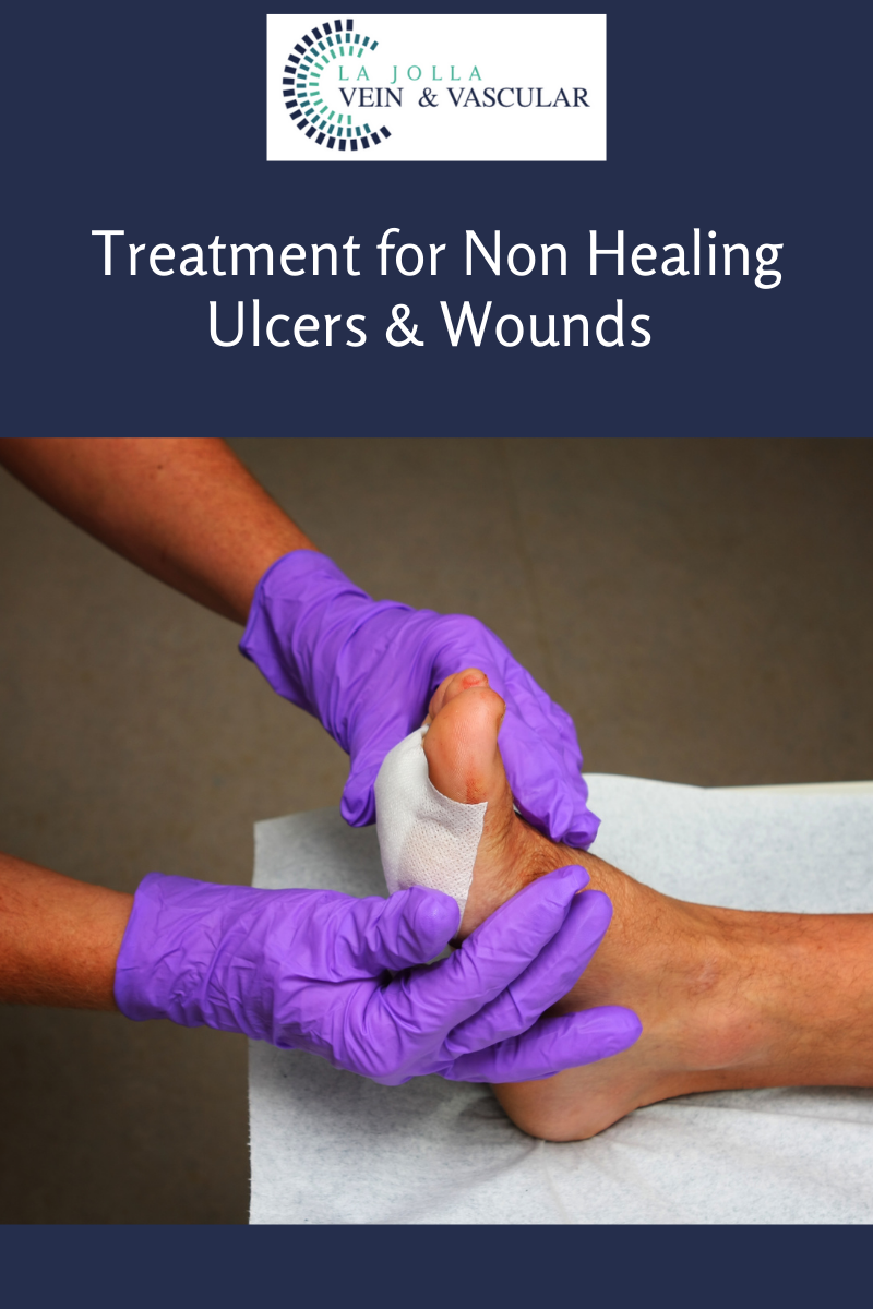 ulcers