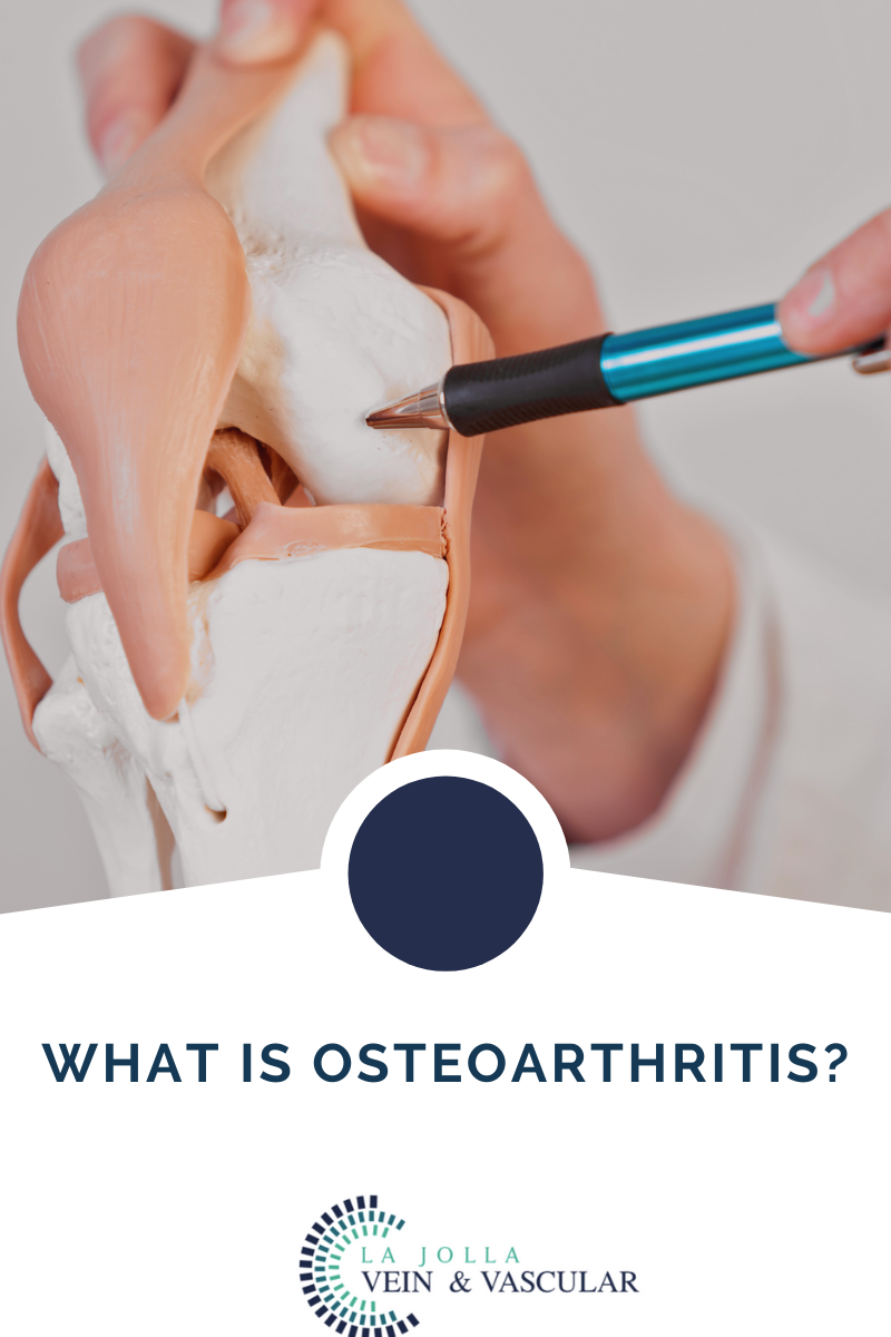 1 osteoarthritis