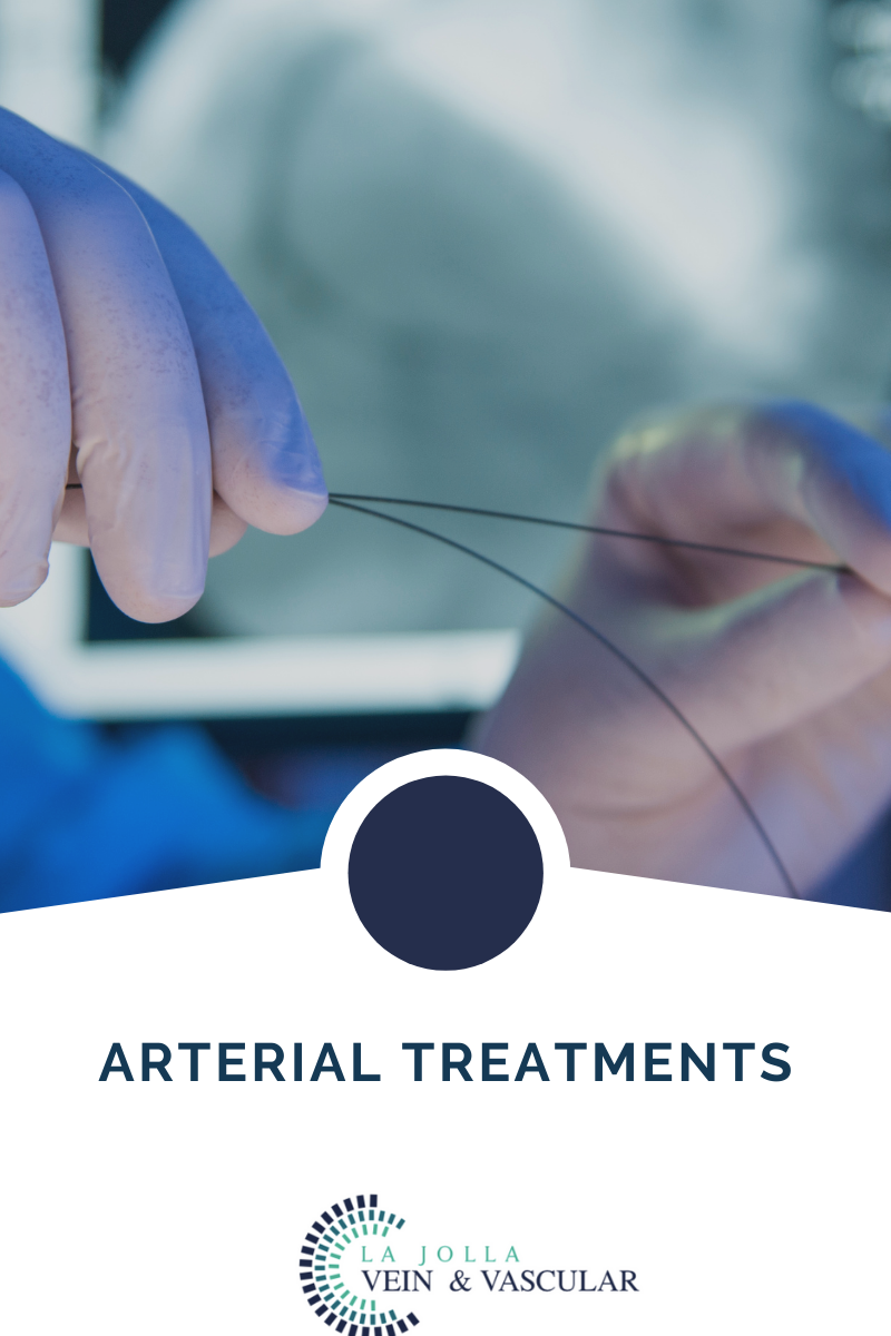 11 arterialtreatments