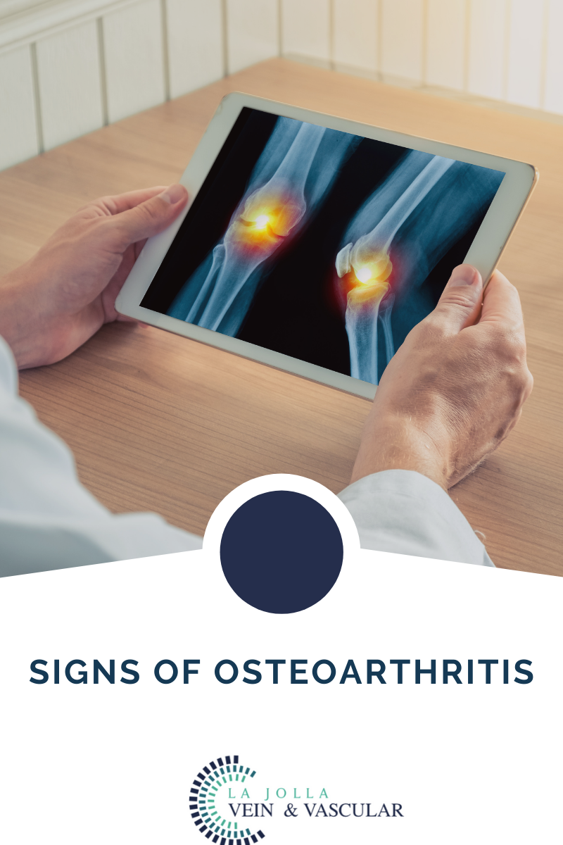 2 osteoarthritis
