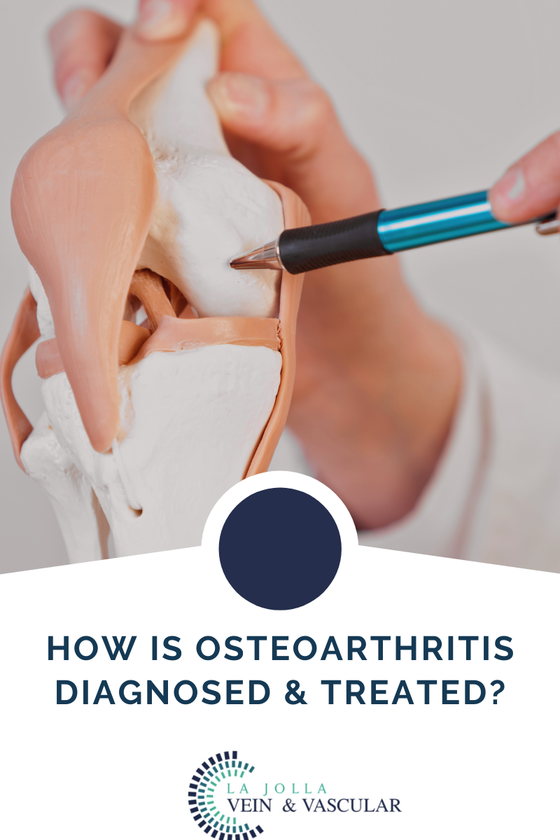 3 osteoarthritis