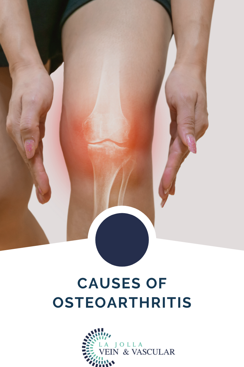 4 osteoarthritis