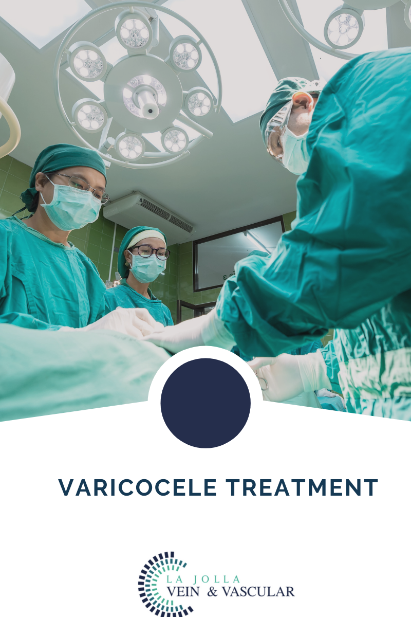 varicocele