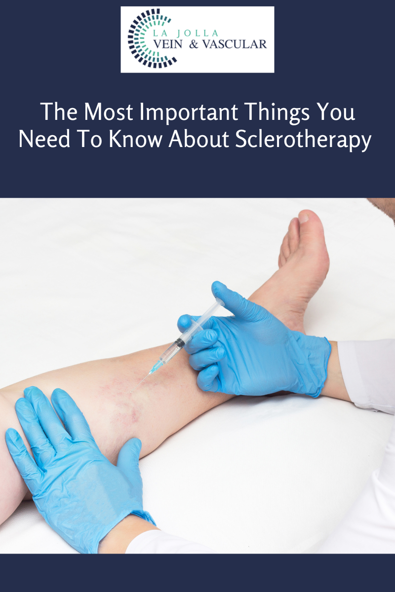 1 sclerotherapy