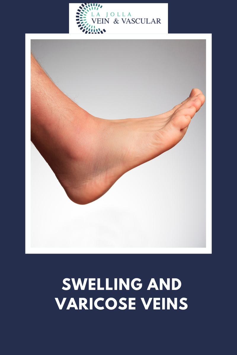 15 swelling