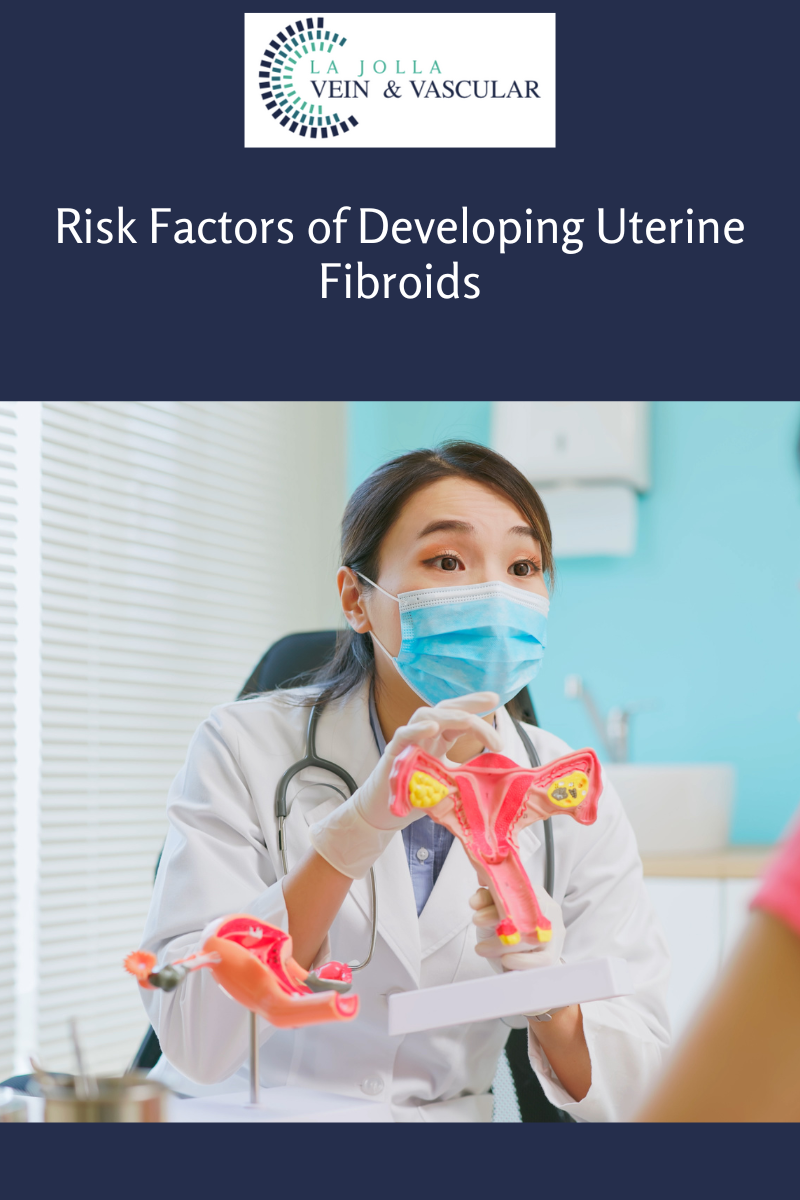 fibroids