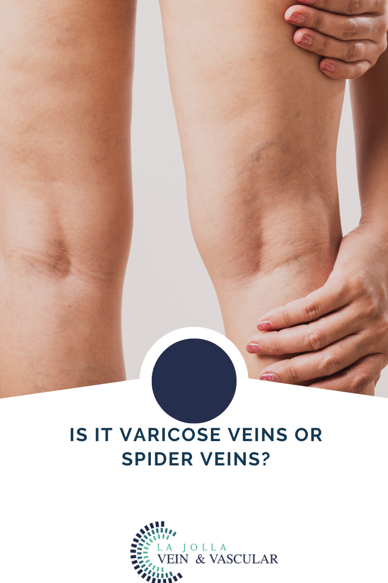 veins