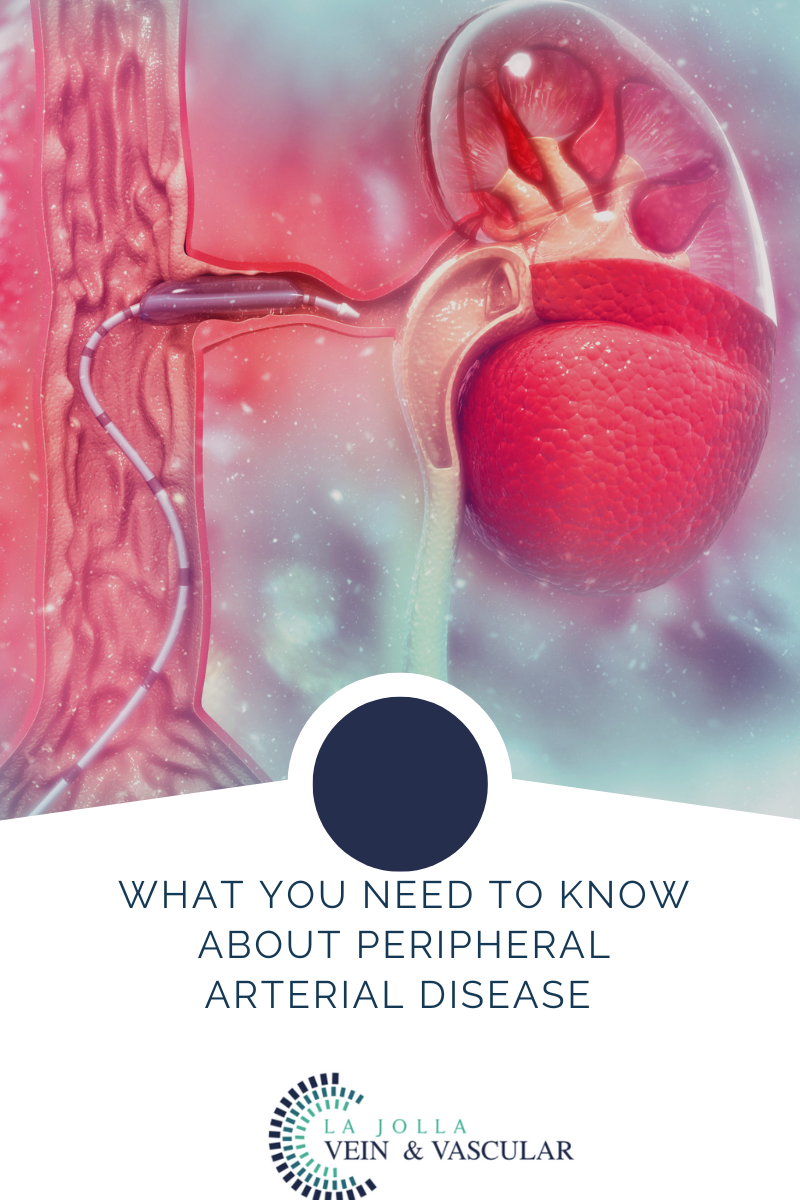 peripheral