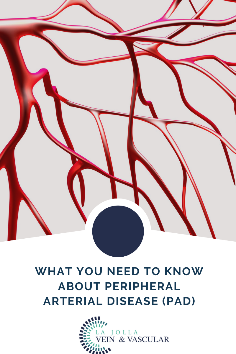 pad1 arterial