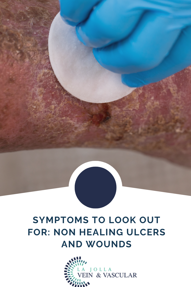 ulcers