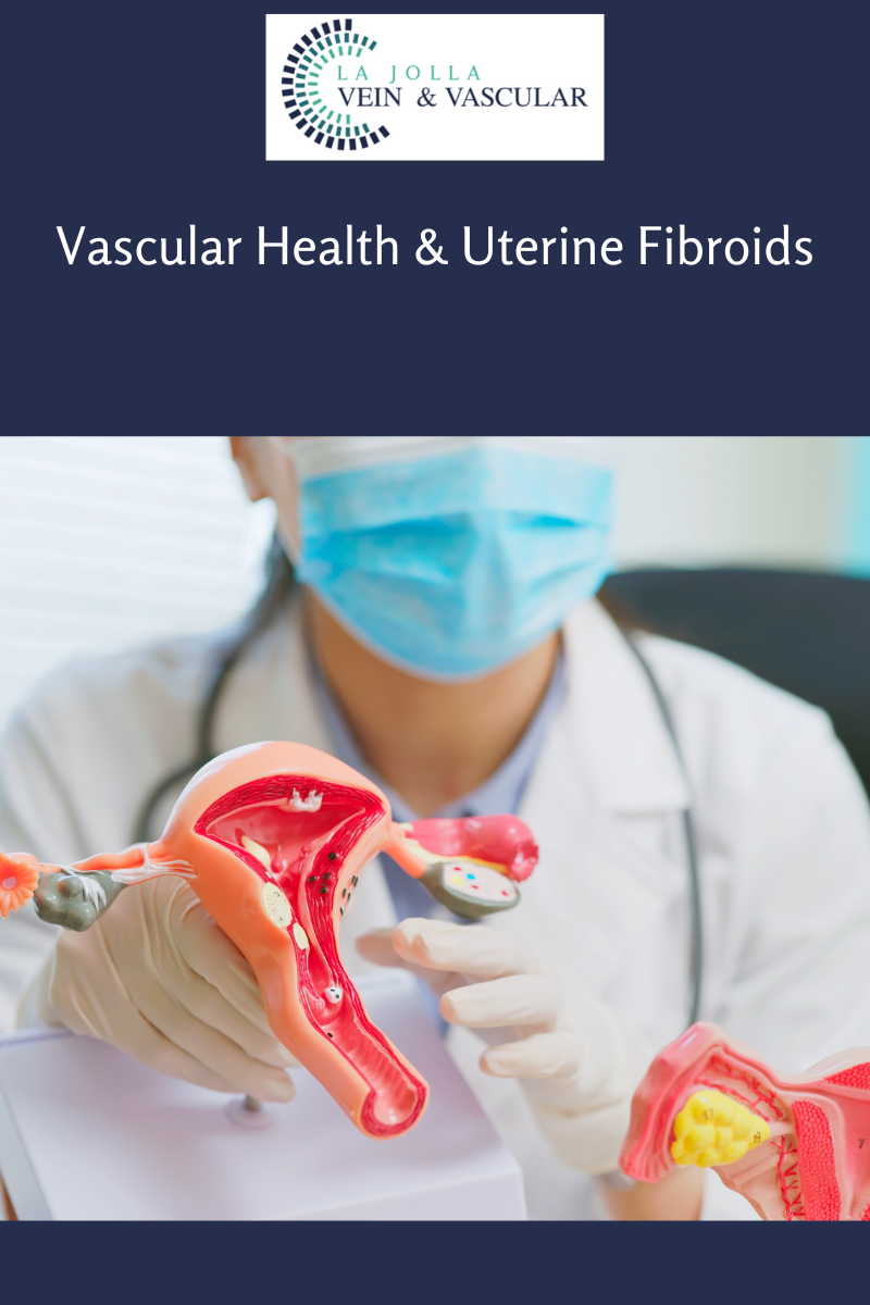 1414 fibroids