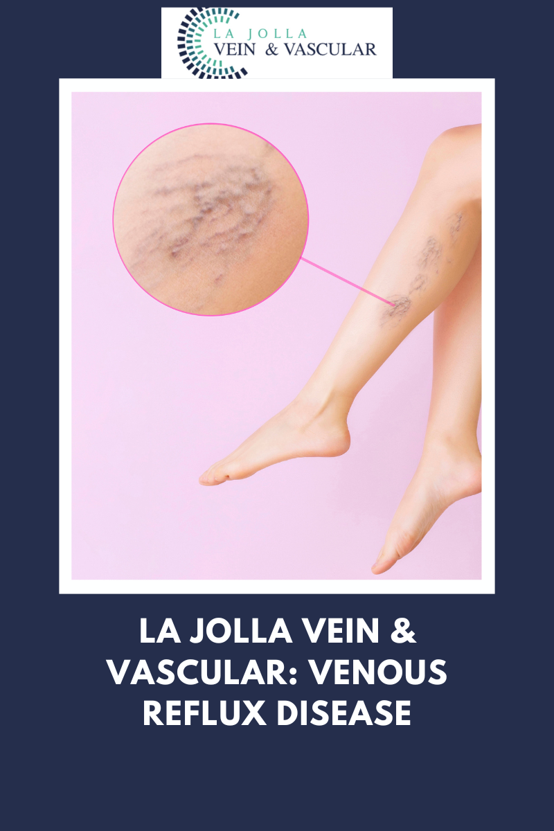 La Jolla Vein & Vascular- Venous Reflux Disease venous reflux disease