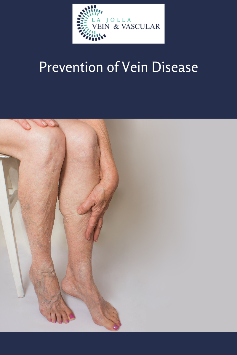 Prevention of Vein Disease vein disease