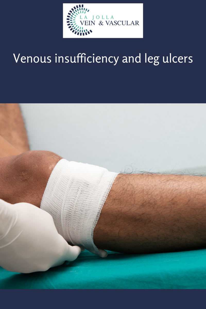 Venous insufficiency and leg ulcers chronic