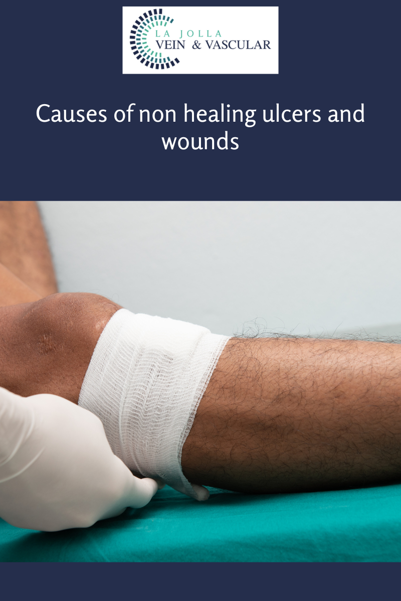 1 ulcers