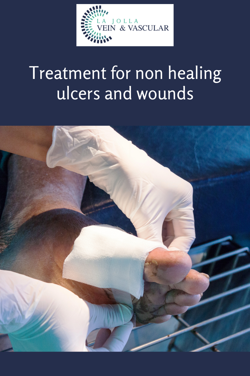 ulcers