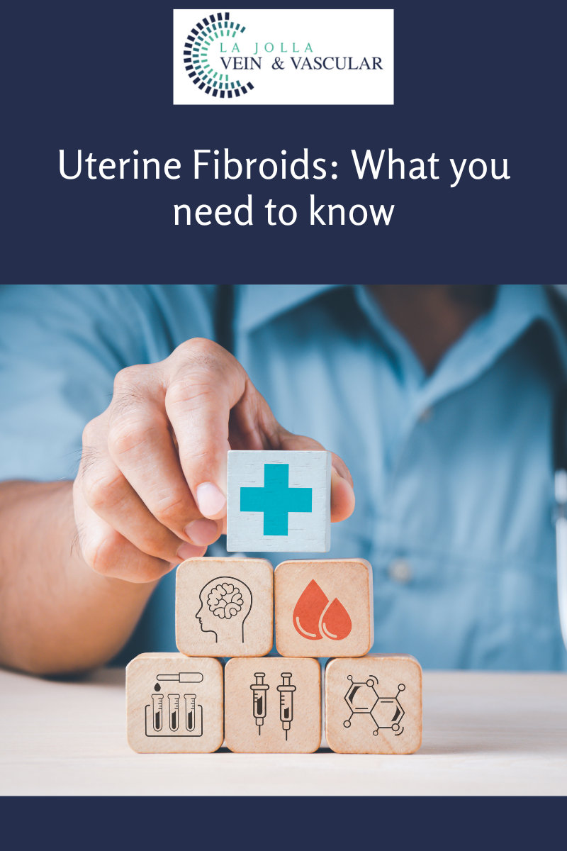 fibroids