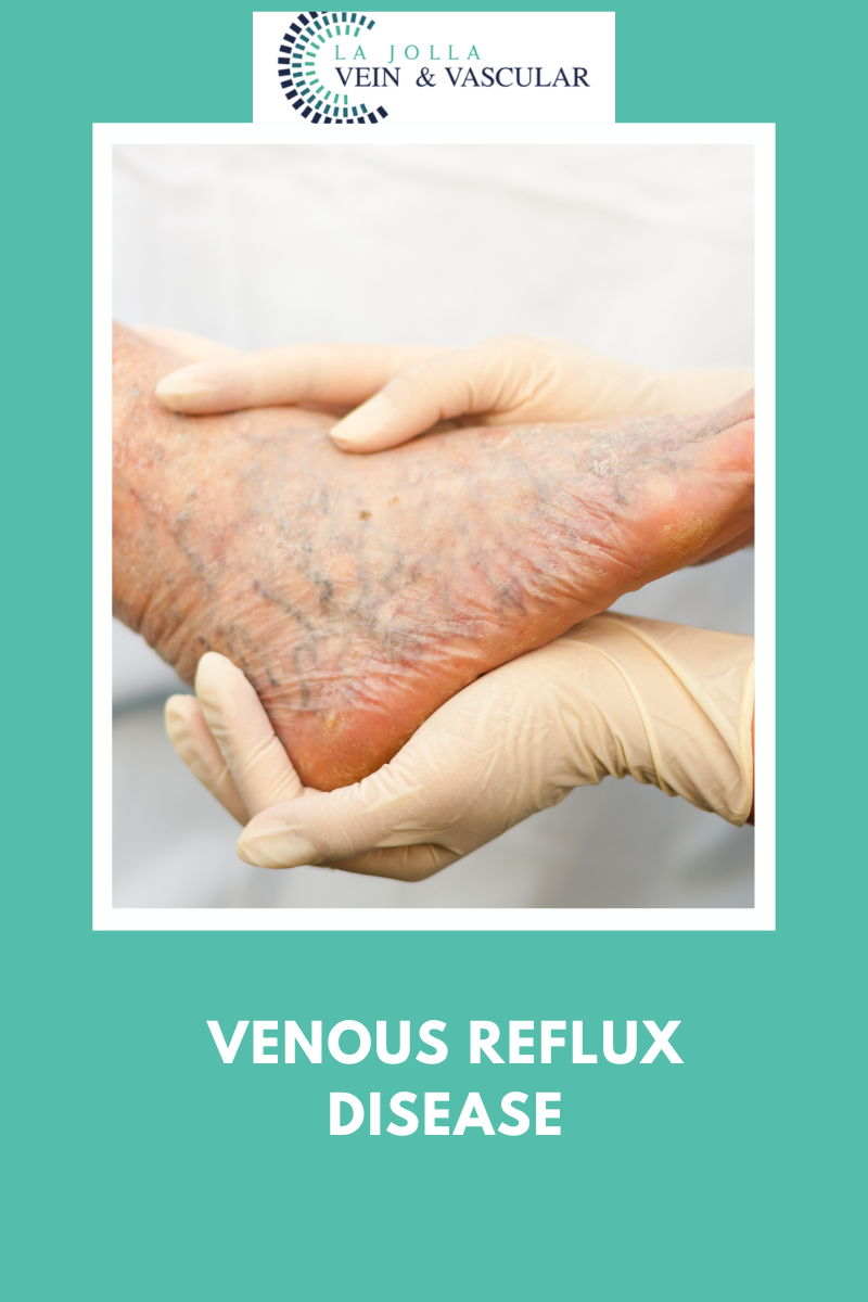16 venous