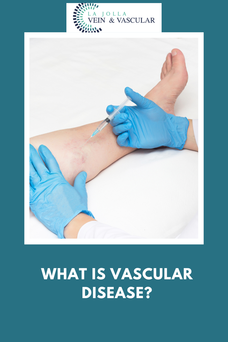 19 vascular