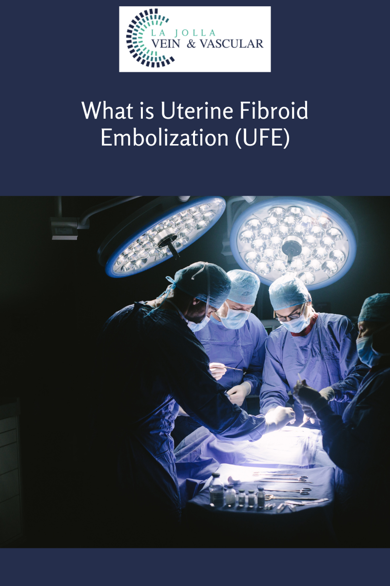 Bunke Blogs New 3-16 What is Uterine Fibroid Embolization