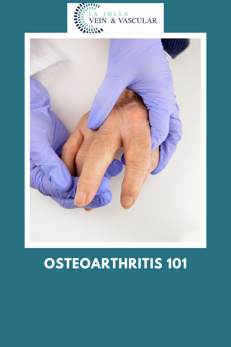 osteoarthritis
