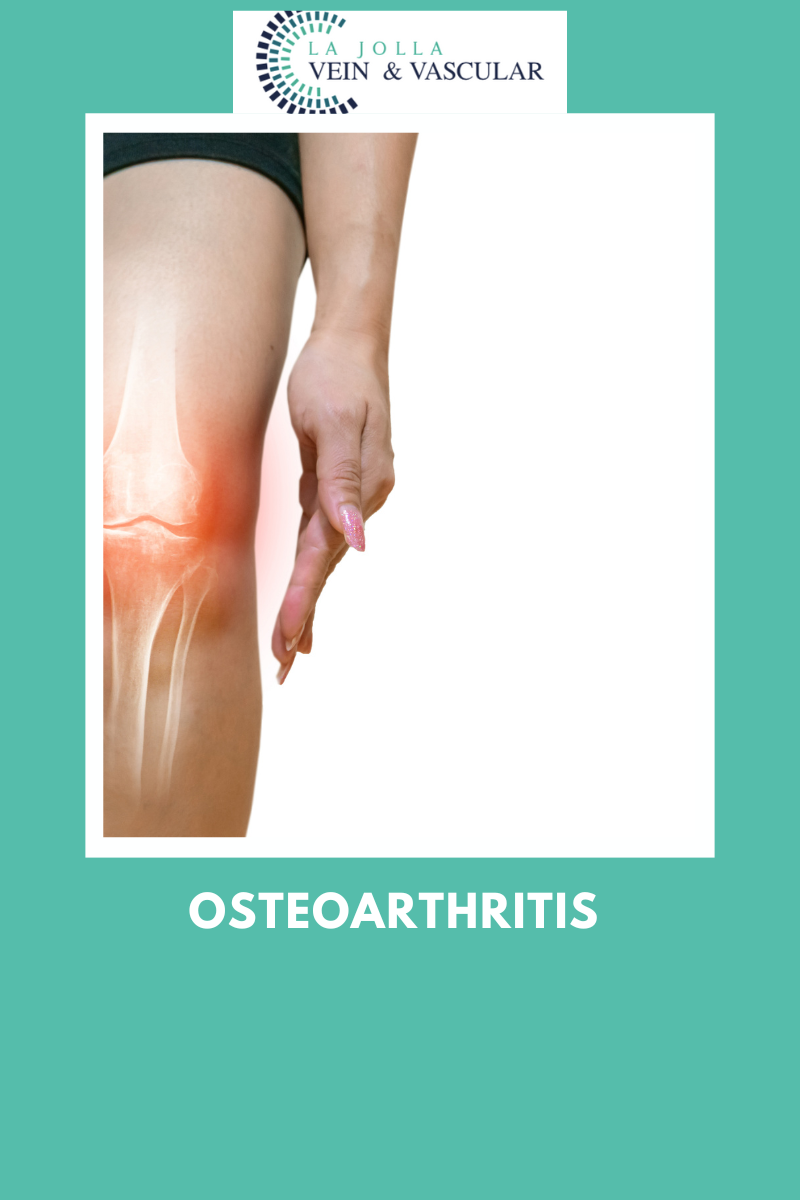 2 osteoarthritis
