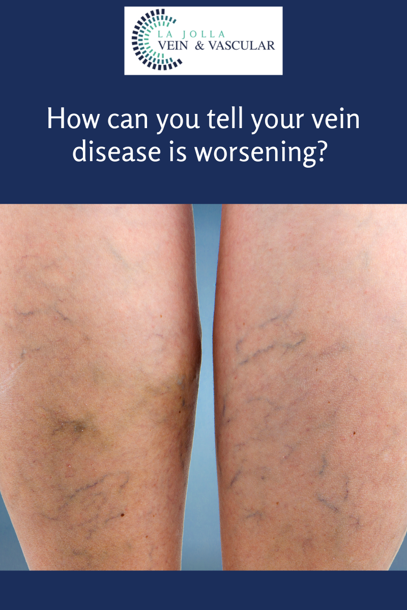 26 vein