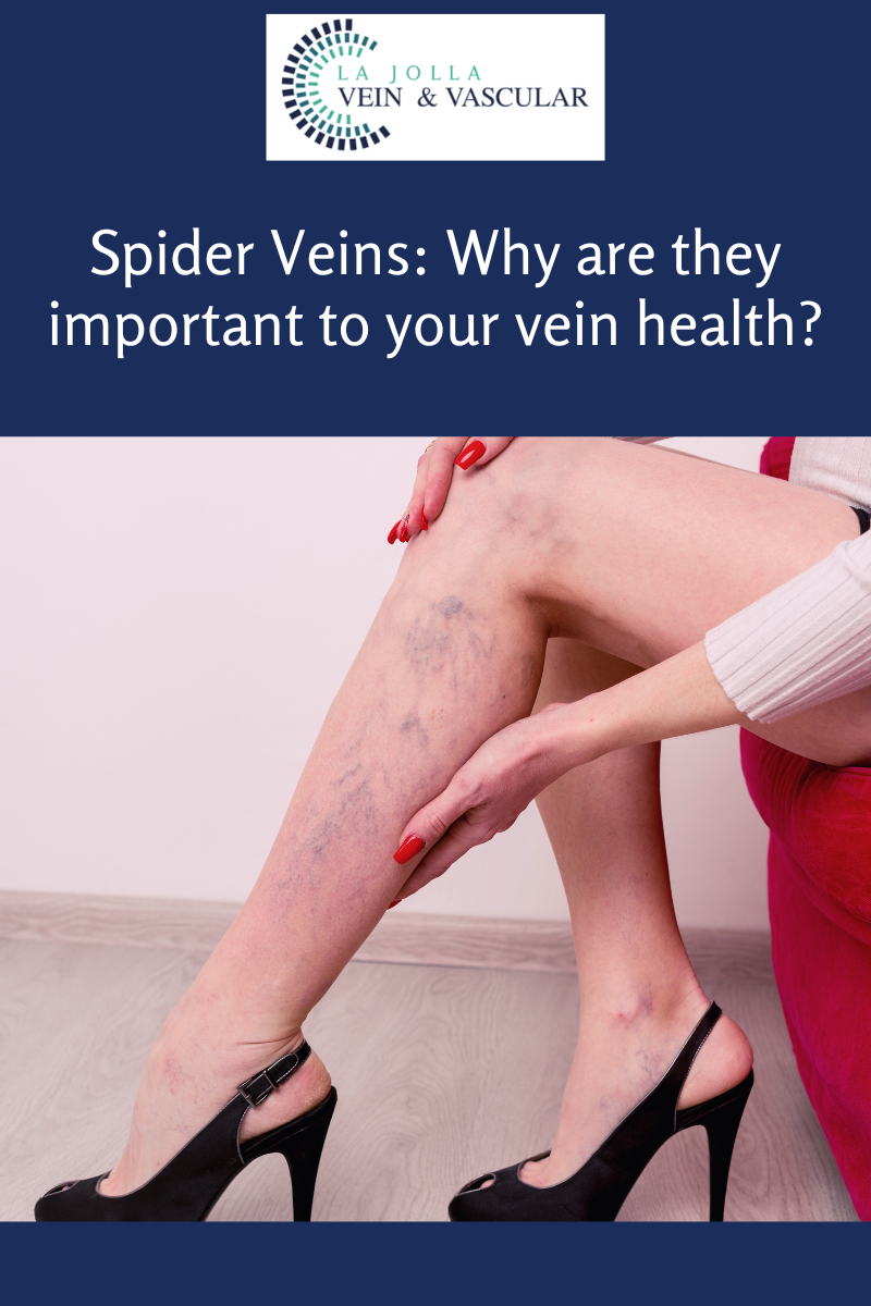 spider veins