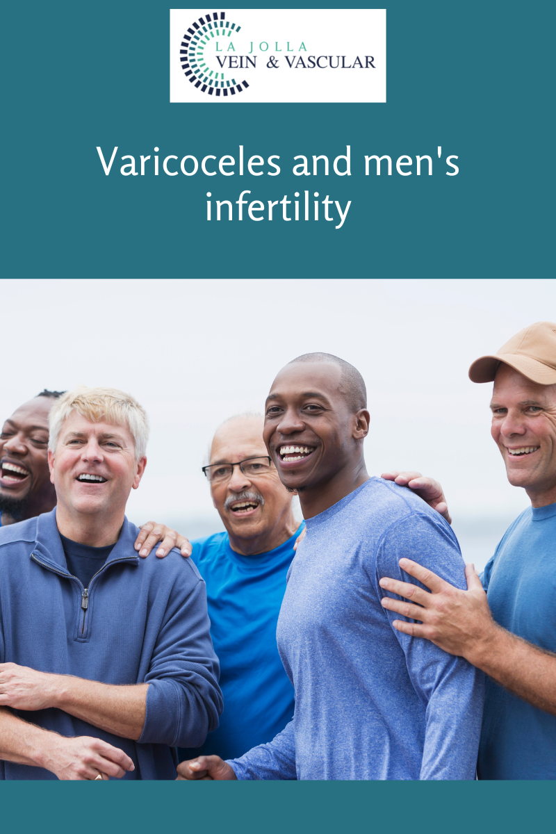 varicocele