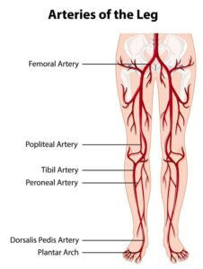 arterial