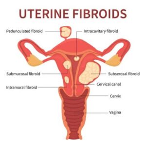 uterine